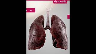 Gynoveda Lung Detox to Reduce Smoking damage Asthma attacks and reverse lung damage [upl. by Hamid607]