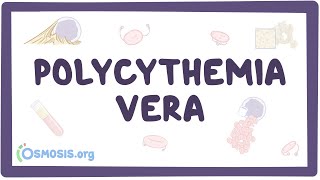 Polycythemia vera  causes symptoms diagnosis treatment pathology [upl. by Grayson]