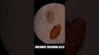 Trichuris trichuria eggs Parasitology [upl. by Bogie846]