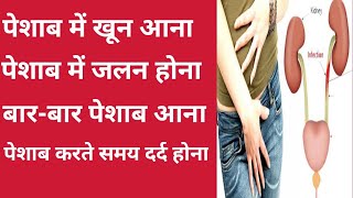 पेशाब में जलन दर्दबारबार पेशाब आना और ब्लीडिंग होनाRK Healthy Tips [upl. by Desdamonna]