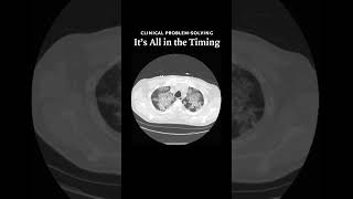 It’s All in the Timing Video 2  NEJM [upl. by Tsan451]