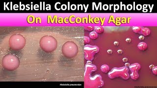 Klebsiella Colony Morpholohy on MacConkey agar [upl. by Shult695]