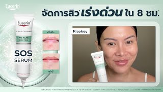 เป็นสิว ใช้มาหลายตัวไม่หาย ลอง Eucerin SOS Serum ลดทั้งสิวและรอยสิว พร้อมคุมมัน [upl. by Rape359]