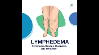 Lymphedema  Symptoms Causes Diagnosis and Treatment [upl. by Ennyletak481]