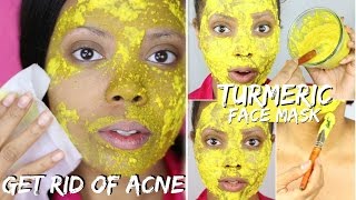 BEST DIY TURMERIC FACE MASK BEFORE AND AFTER PHOTOS  BEST ACNE TREATMENT TO FIGHT ACNE TASTEPINK [upl. by Adekam]