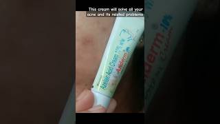 Aziderm 10 cream review how to use azelaic acids cream 10 ww shorts youtubeshorts [upl. by Inalaehak201]