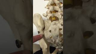 Rhizotomy of the SacroIliac Joint [upl. by Jo Ann]