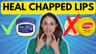 10 TIPS TO HEAL CHAPPED LIPS FAST 👄 Dermatologist DrDrayzday [upl. by Novaat]