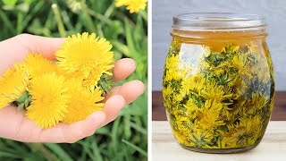 9 Ways To Use Spring Dandelions [upl. by Jonati718]