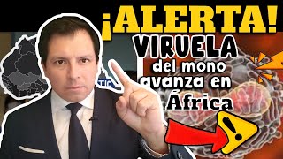 ALERTA⚠️ VIRUELA DEL MONO AVANZA EN ÁFRICA [upl. by Alabaster]