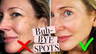 How To Get Rid of Age Spots [upl. by Seibold]