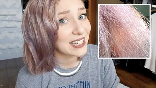 PART 1 HOW I FIXED EXTREMELY DAMAGED HAIR [upl. by Heyman]