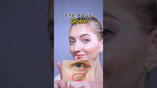 eye bags gone🔥 eyebags faceexercises faceyoga facefitness facemassage [upl. by Bruns]