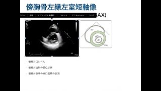 【心エコー】初めての心エコー（UCG）について 第３話 傍胸骨左縁左室短軸像 僧帽弁レベルから心尖部まで [upl. by Bergren903]