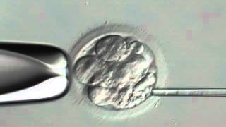 INSTITUT MARQUÈS  Embryo Fragment Removal  IVF [upl. by Ayeka346]