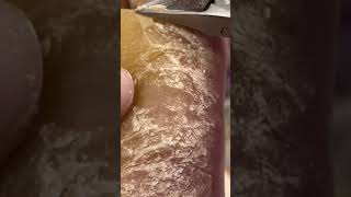 Skin picking PART 2 Flaking off foot callus w hyperkeratosis EPPK  Apr 27 2023 [upl. by Nodlehs]