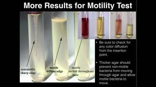 Microbiology Motility Test [upl. by Aynatan]