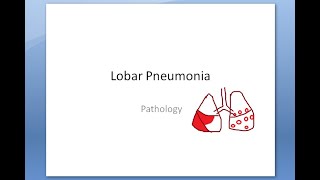 Pathology 465 a Lobar Pneumonia Lung Inflammation Pneumonitis Types Classify Red Hepatization Grey [upl. by Gaillard]