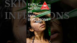 What are Early Signs of Skin Infections😱😵 shorts skininfection [upl. by Brookner711]