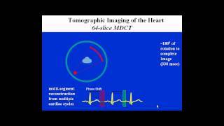 CCTA Training Lecture 1B Temporal and Spatial Resolution in Cardiac CT [upl. by Cut562]