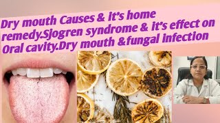 Dry mouth Causes amp its home remedySjogren syndrome amp its effect on Oral cavityDry mouth fungal [upl. by Notlimah]