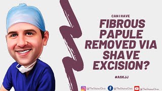 Can I have a fibrous papule removed via shave excision [upl. by Nagorb]