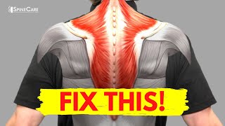 How to Fix Muscle Knots in Your Neck and Shoulder in 30 SECONDS [upl. by Aleuname]