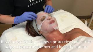 Microdermabrasion with Biocellulose Mask and LightStim Light Therapy [upl. by Suriaj880]