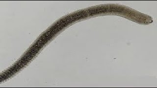 Para GIT  Hymenolepis Nana  Dwarf tape worm   الدودة القزمة [upl. by Akin23]