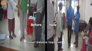 Motor Axonal Neuropathy Treatment Results  Quick Look  No 3084 [upl. by Py]