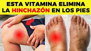 ESTA es LA MEJOR VITAMINA para ELIMINAR la HINCHAZÓN en PIES y PIERNAS [upl. by Mathe448]