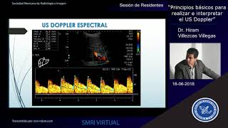 Sesión de Residentes  Principios básicos para realizar e interpretar el US Doppler [upl. by Eynaffit]