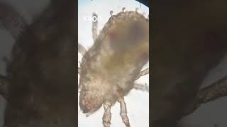 Microscopic Mite music microscope ponds bug evolution life cell tiny microbiology [upl. by Hammad]