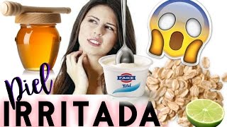 PIEL IRRITADA Dia 1 😫 Mascarilla de Avena Yogurt y Miel FUNCIONARA [upl. by Anna-Maria]