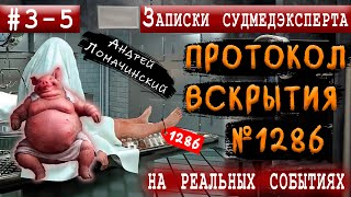 Записки Судмедэксперта  3 4 5 Три Трагичных Истории  Реальные Истории Из Медицинской Практики [upl. by Nnoryt562]