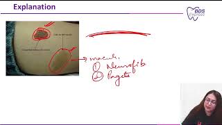 NEET MDS 2024 OMDR  Café au Lait Spots amp Associated Syndromes [upl. by Adnirol]