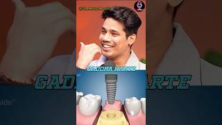 Dental Implant Is Painful 😖 short youtubeshorts gamerfleet [upl. by Walls]