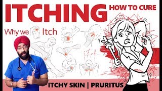 How to Cure ITCHY SKIN  ITCHING  PRURITUS  100 Medical Science in ENG  DrEducation [upl. by Aurore]