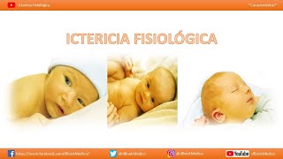 Ictericia Fisiológica  Ictericia neonatal [upl. by Ltney312]