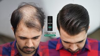 Hair Style For Very Thin amp Balding Hair by using Hair Fibers 2022 [upl. by Lezned]