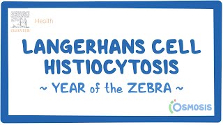 Langerhans cell histiocytosis Year of the Zebra [upl. by Atwekk]