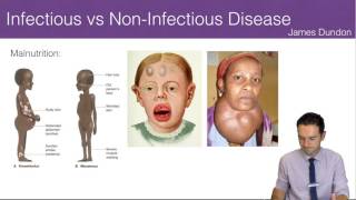 Infectious vs NonInfectious Disease [upl. by Anahsat735]