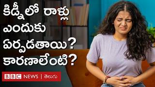 Kidney Gall bladder Stone ఎలా ఏర్పడుతుంది సరైన చికిత్స తీసుకోకపోతే ఏమవుతుంది  BBC Telugu [upl. by Nwaf]