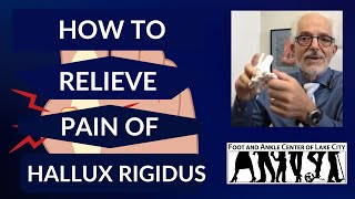 Hallux Rigidus Symptoms Causes and Treatment [upl. by Scarlet]