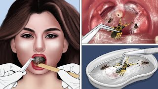 ASMR Animation Removing spiders and spider silk from Selena Gomezs mouth [upl. by Caitrin]