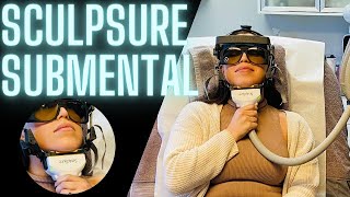 SCULPSURE SUBMENTAL CHIN PROCEDURE  FAT CONTOURING LASER [upl. by Anila794]