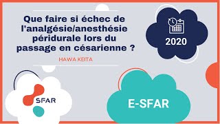 Que faire si échec de lanalgésieanesthésie péridurale lors du passage en césarienne  H KEITA [upl. by Eihs]