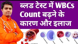 High Wbcs Count In Blood  ब्लड में WBCs बढ़ने के कारण और इलाज  High Wbc Count Treatment In Hindi [upl. by Crysta]