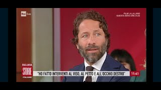 STORIA DI UN RAGAZZO SFREGIATO CON L’ACIDO  RAI TV STORIE ITALIANE [upl. by Eniledgam]