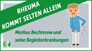 📢Rheuma kommt selten allein Morbus Bechterew und seine Begleiterkrankungen  Rheuma  Liga [upl. by February]